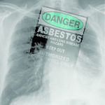 Asbestos a workplace health hazard